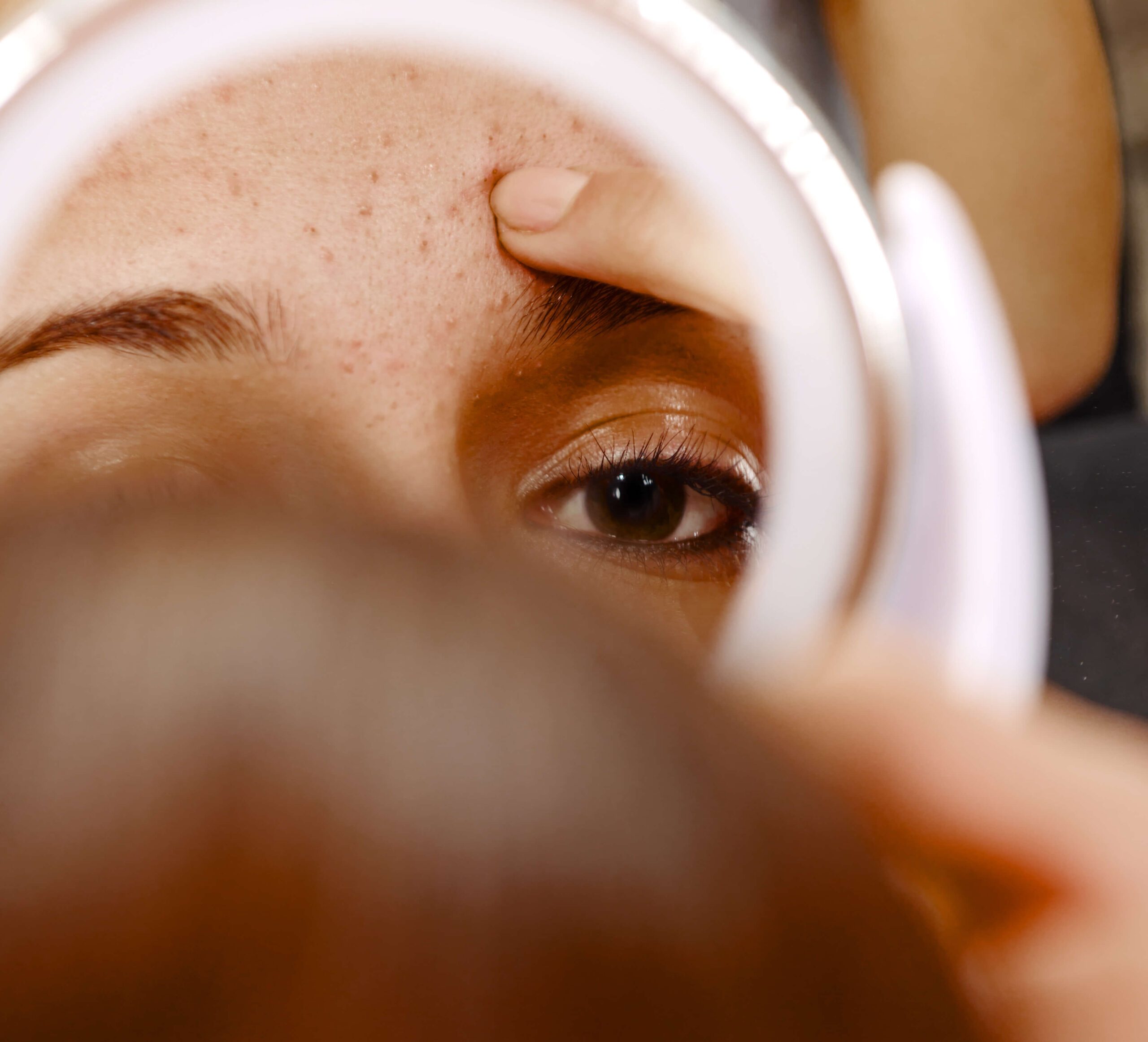 acne scars and skin texture woman looking in mirror at a blemish the eye wearhouse olds alberta